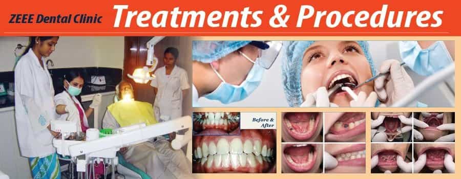 Dental Treatments in New Delhi, India